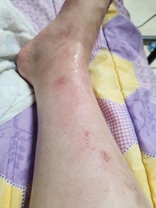 교통사고 또 남