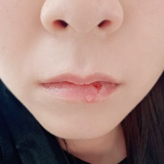 현재 다빙구 상태(혐짤주의)