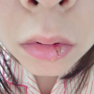 현재 다빙구 상태(혐짤주의)